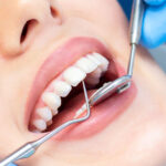 5 Reasons Why Professional Dental Cleaning Is Essential