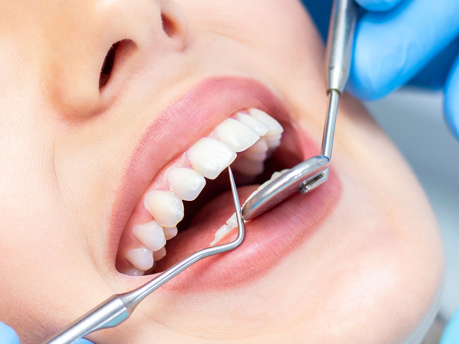 5 Reasons Why Professional Dental Cleaning Is Essential